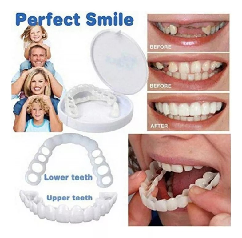 Protesis Dentada Carillas